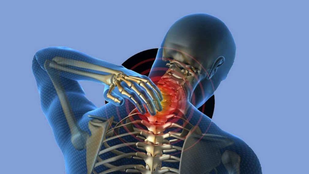 Osteochondrosis of the cervical area