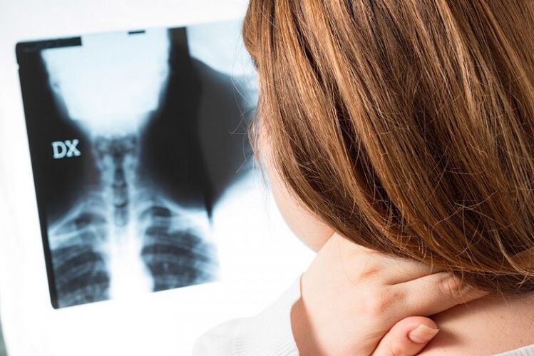 X -ray cervical area