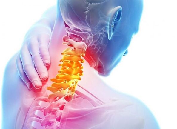 Cervical spine osteochondrosis