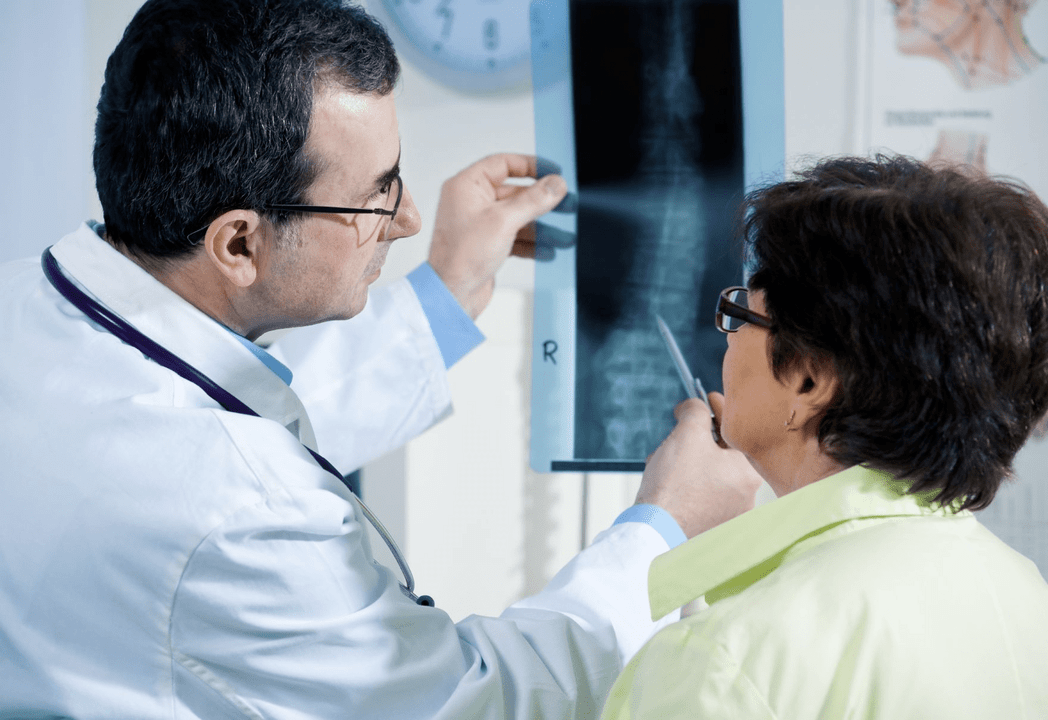 A neurologist diagnoses osteochondrosis using a spinal radiograph